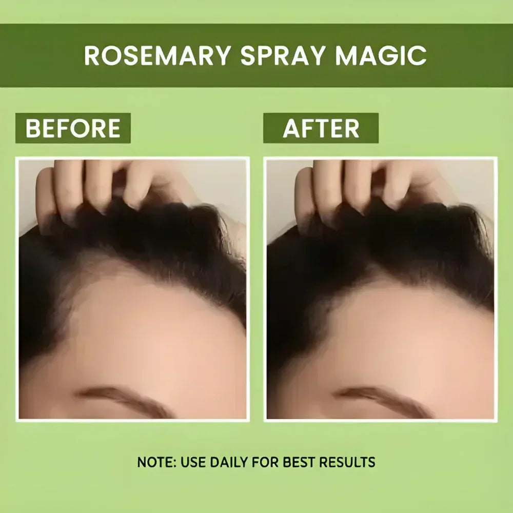 Rosemary Water Spray | For Hair Regrowth (Buy 1 Get 2 Free 馃槏)