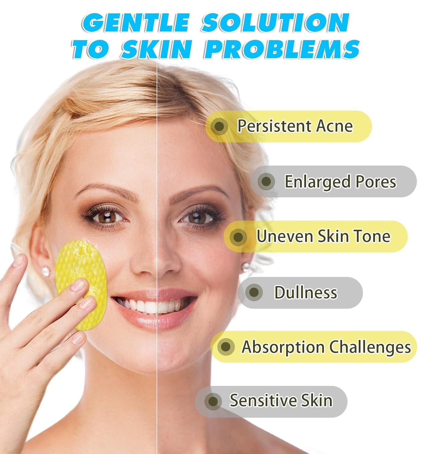 KojicFresh鈩� - Turmeric Kojic Acid Cleansing Pads |馃敟PACK OF 60 PADS馃敟